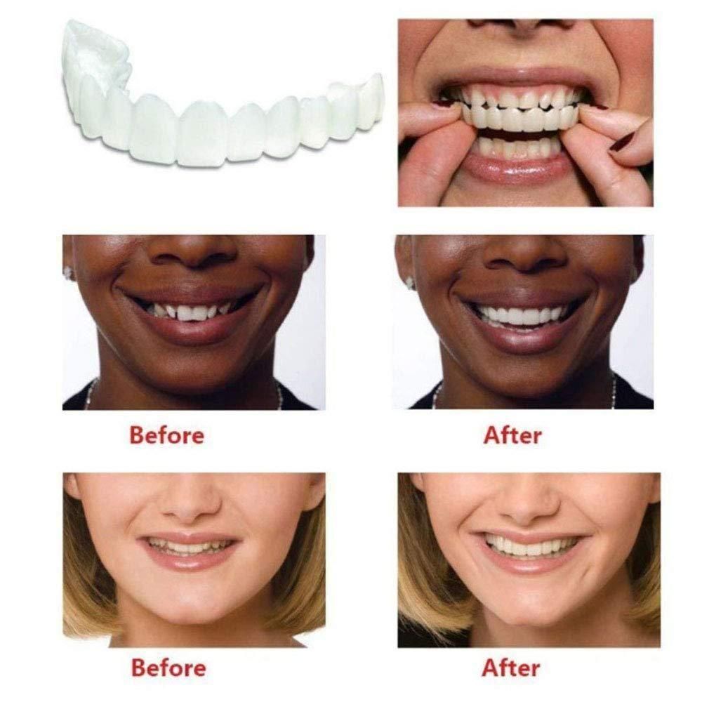 Instant and Confident on Smile Fit Flex Cosmetic Teeth Denture Teeth