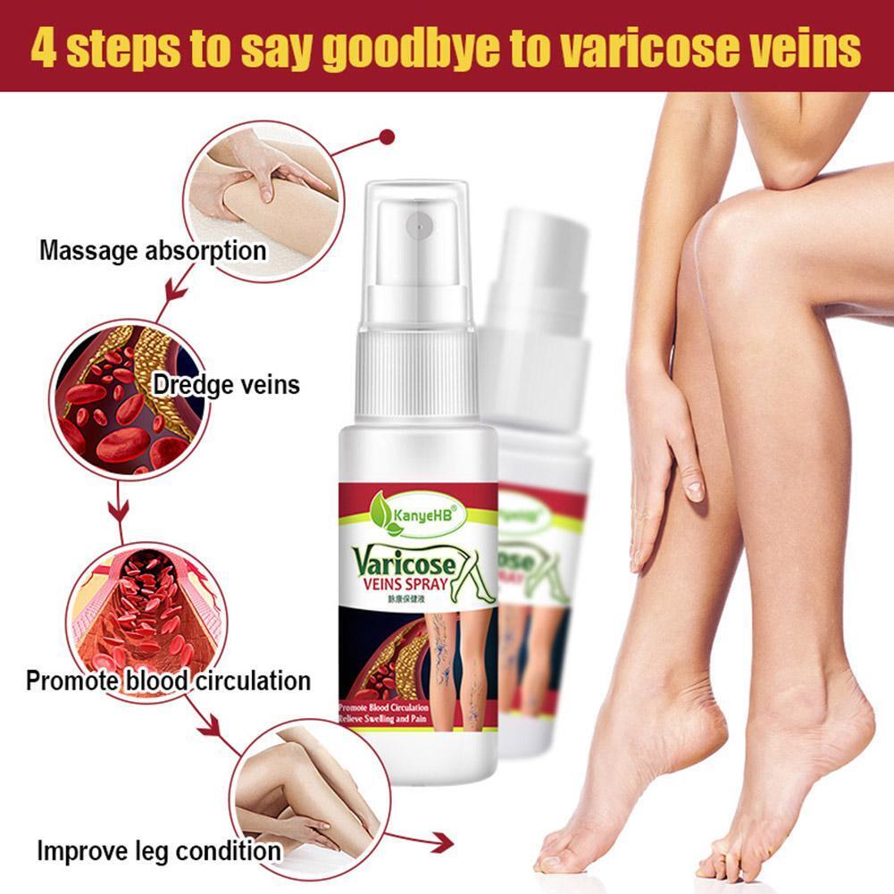 Varicose Veins Treatment Spray