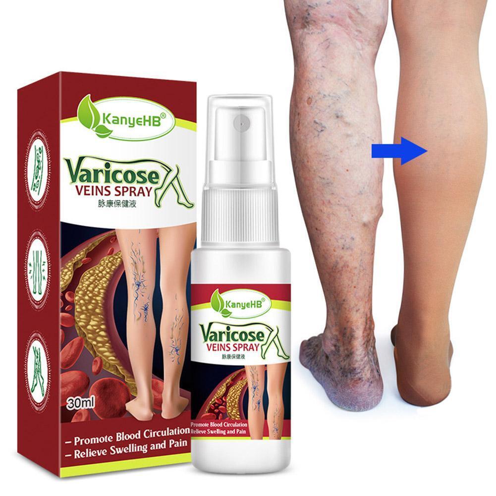 Varicose Veins Treatment Spray