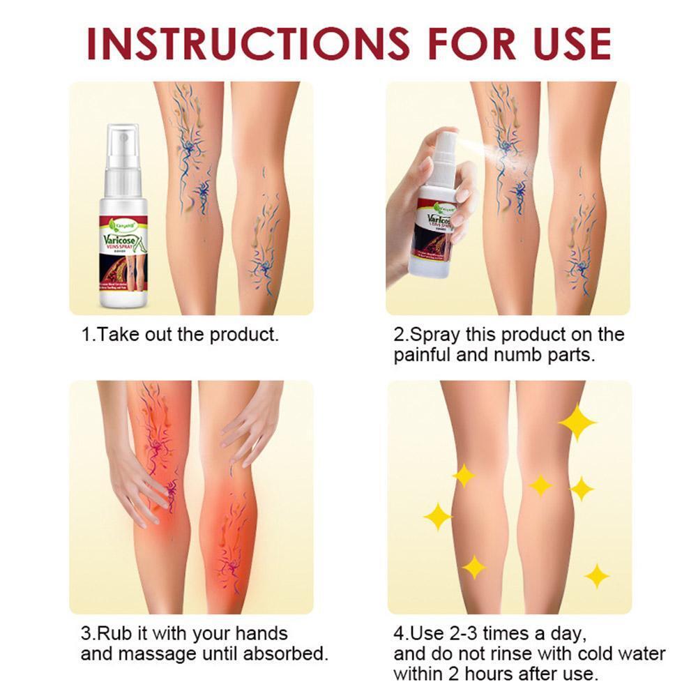 Varicose Veins Treatment Spray